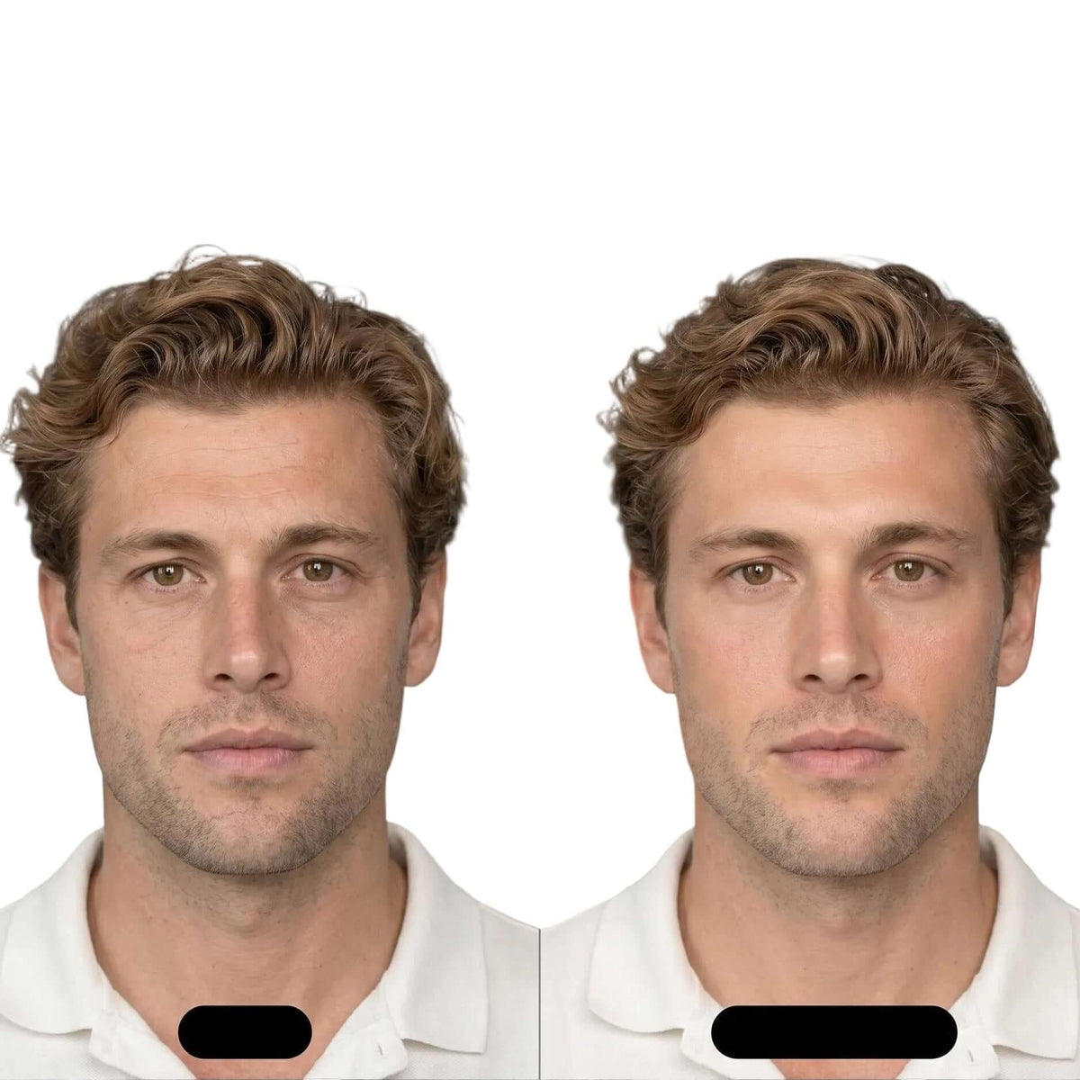 Before and after effect of using Bakuchiol Night Oil Serum on men's skin showing smoother appearance.